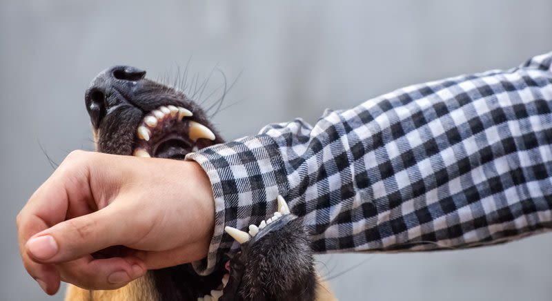 Dog biting mans arm