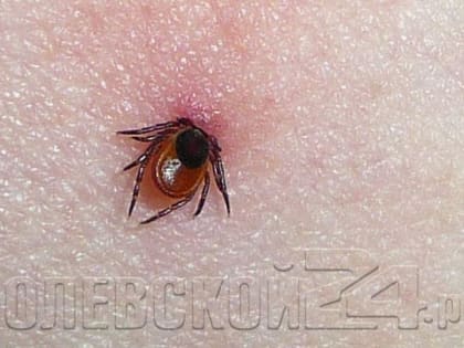 Уже двух полевчан укусили клещи. С почином!