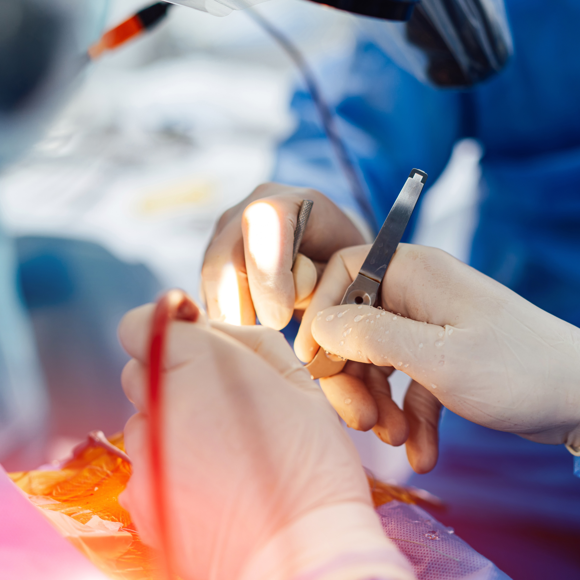 Neurocirurgia