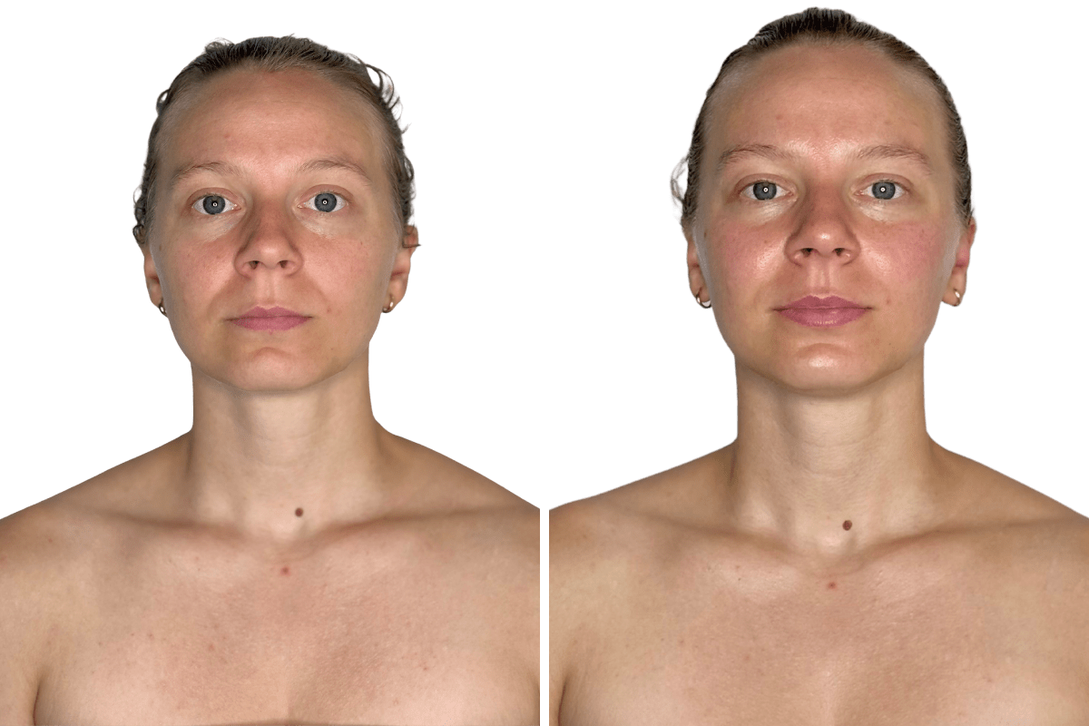 Before and after a single Welcome Bundle session at Altru Radiance — visible jaw and neck lift and lymphatic drainage in Murray, Utah