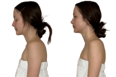 left profile thumbnail