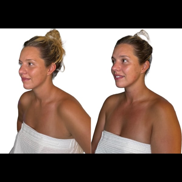 buccal massage sympathetic parasympathetic shift before after murray utah altru radiance