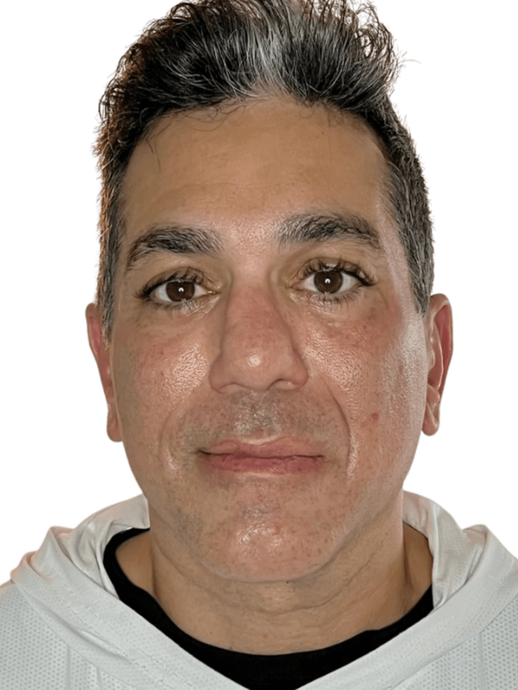 After — Restorative Buccal Facial front view, jaw tension softened, jaw definition and neck elongation visible, Murray Utah