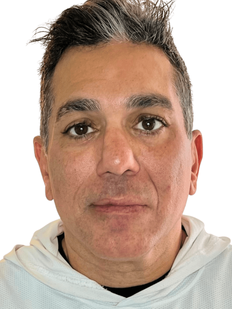 Before — Restorative Buccal Facial front view, held jaw tension and heaviness through the neck, Murray Utah
