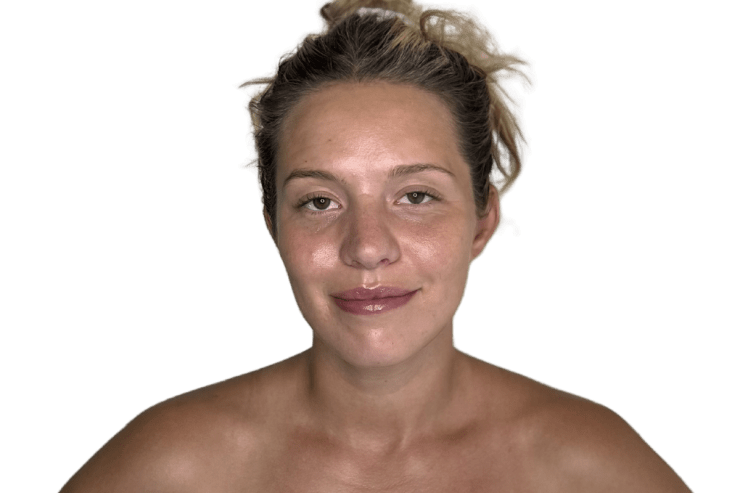 The Restorative Buccal Facial before — held jaw tension and neck pattern, Murray Utah Altru Radiance