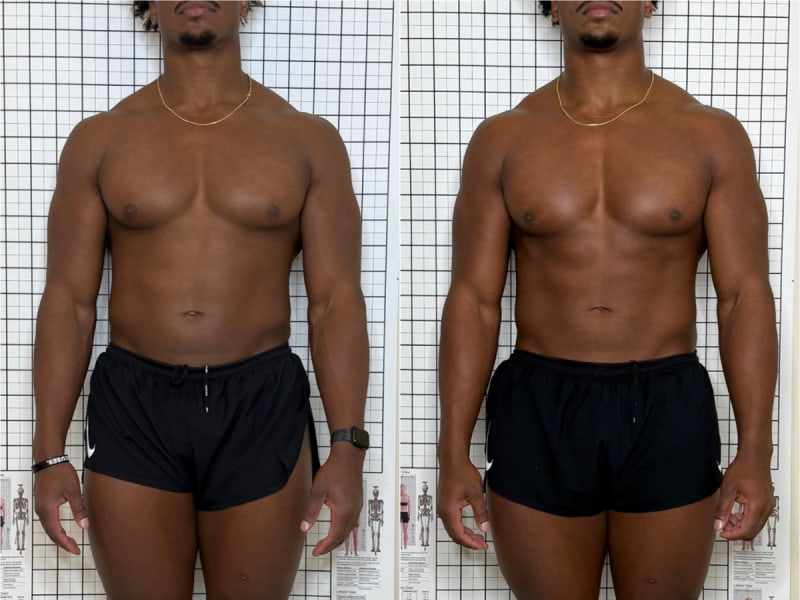 Sculpt lymphatic drainage massage before and after, front view, one session, Murray Utah, Altru Radiance