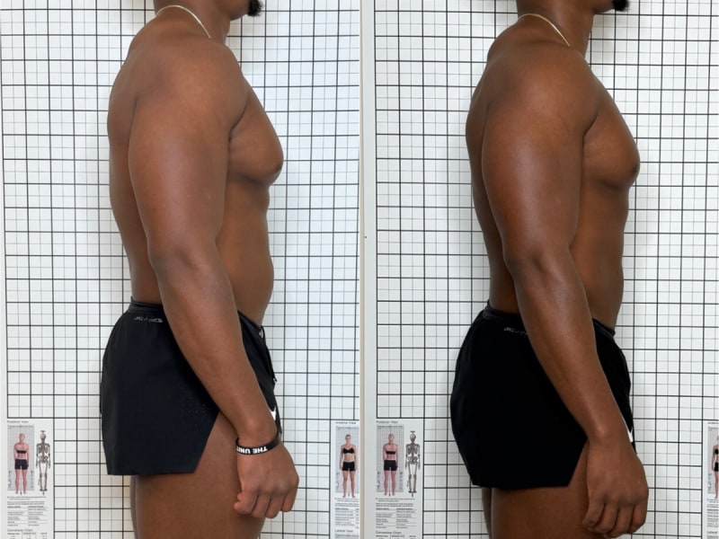 Sculpt lymphatic drainage massage before and after, side view, one session, Murray Utah, Altru Radiance