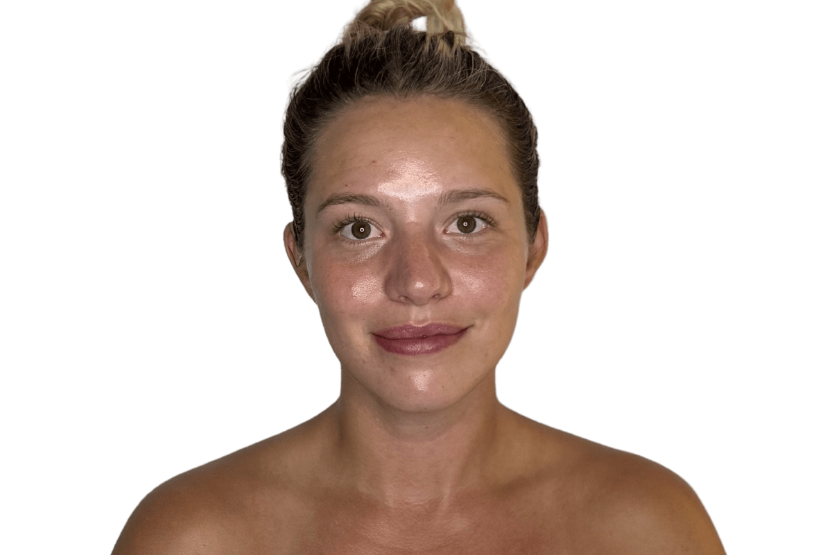 After the Restorative Buccal Facial at Altru Radiance Murray Utah, softer jaw tension, more facial symmetry, lymphatic flow supported