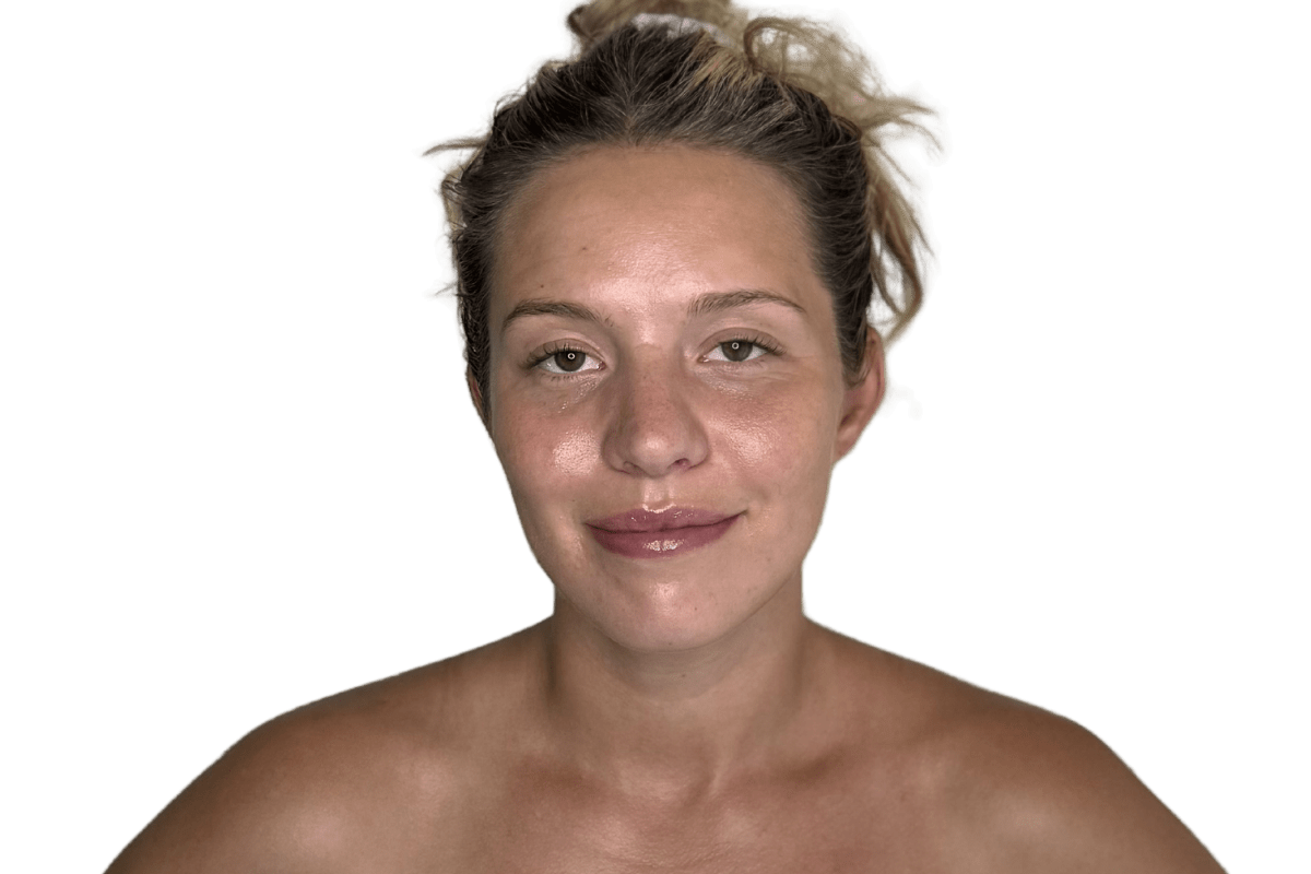 Before the Restorative Buccal Facial at Altru Radiance, held jaw tension, facial asymmetry, held lymphatic flow