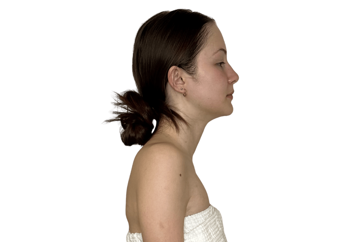 After structural integration at Altru Radiance Murray Utah — corrected forward head posture, elongated neck, decompressed cervical spine