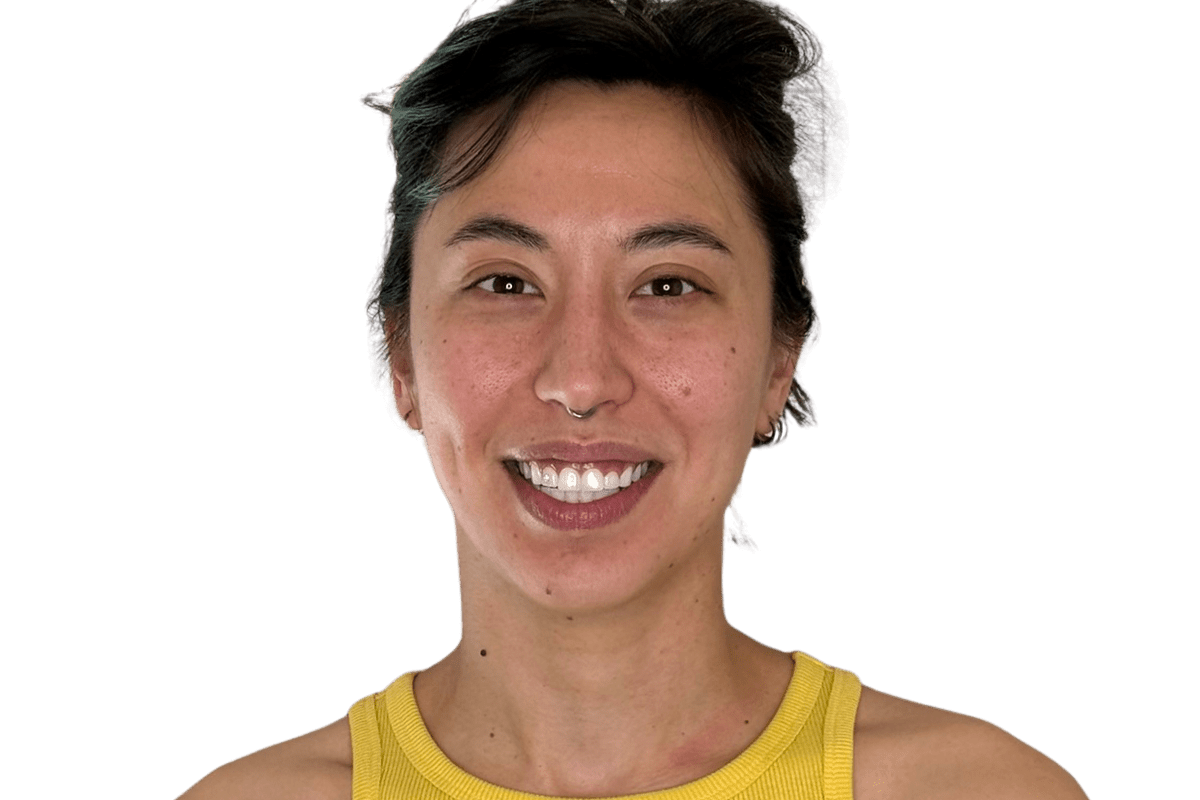Before Restorative Buccal Facial — the face reads unevenly, Salt Lake City area