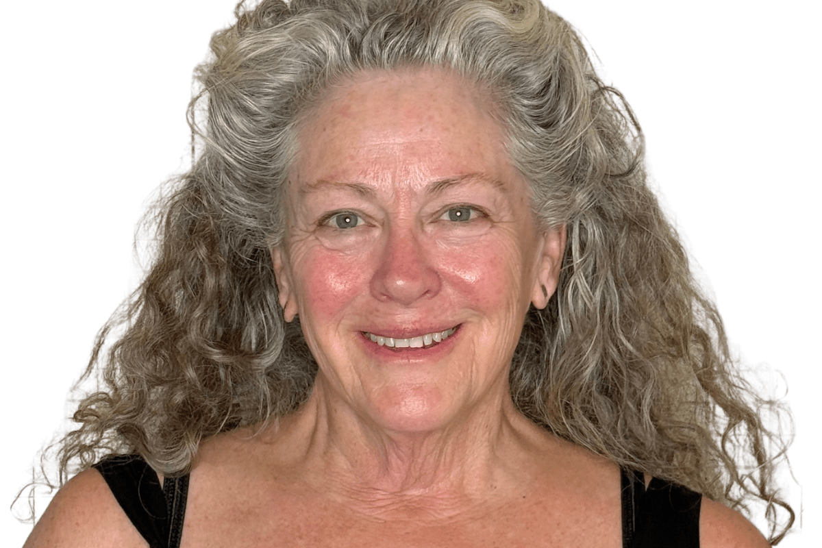 After Restorative Buccal Facial — lymphatic drainage and fascia rehydration, puffiness cleared, skin radiance and natural lift returned, Murray Utah Altru Radiance