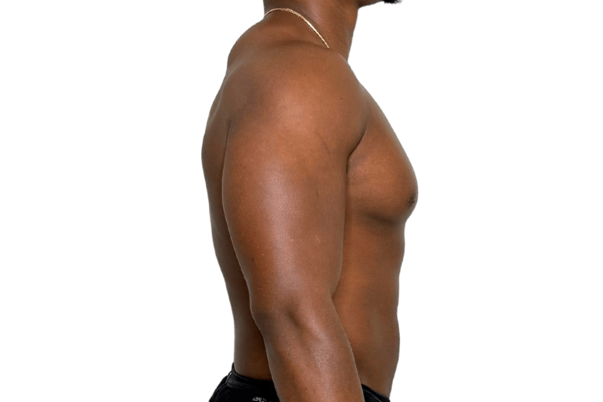 After SOOTHE lymphatic drainage lateral anterior chain release Murray Utah