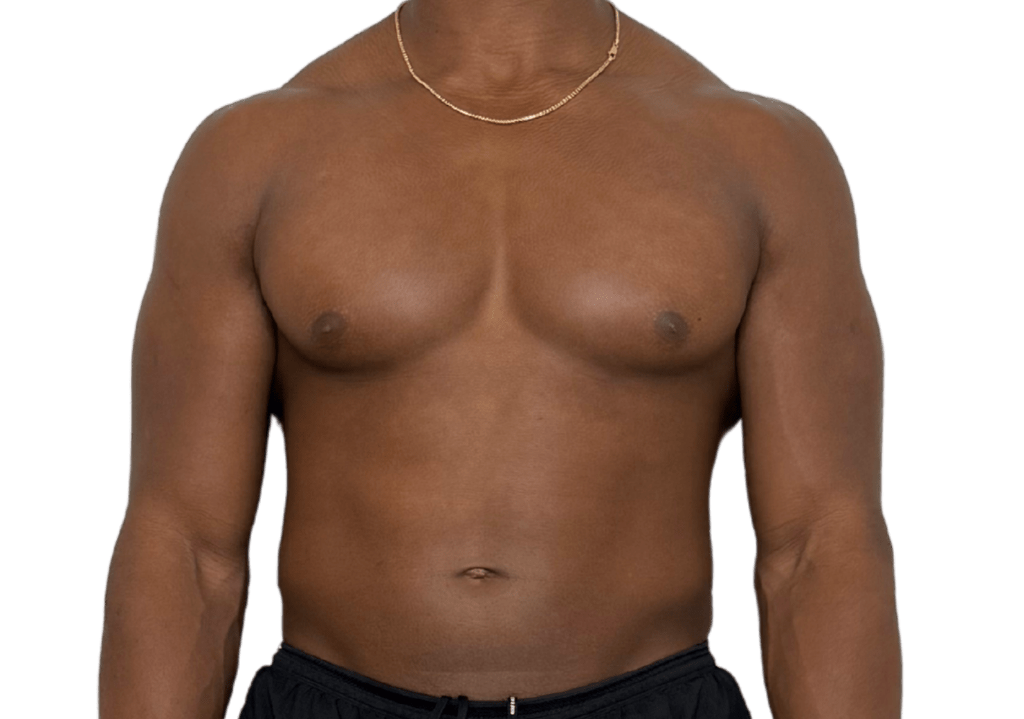 Before SOOTHE lymphatic drainage anterior chain compression Murray Utah