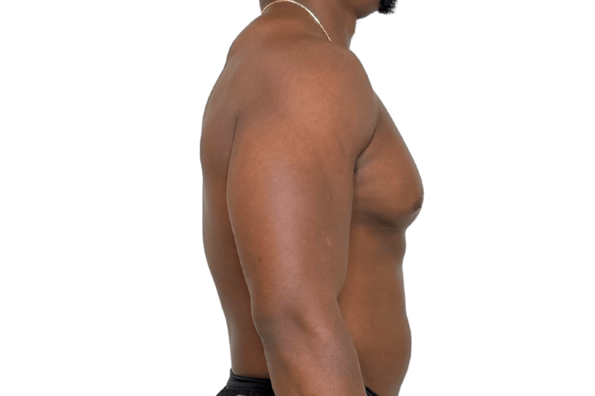 Before SOOTHE lymphatic drainage lateral profile anterior chain compression Murray Utah