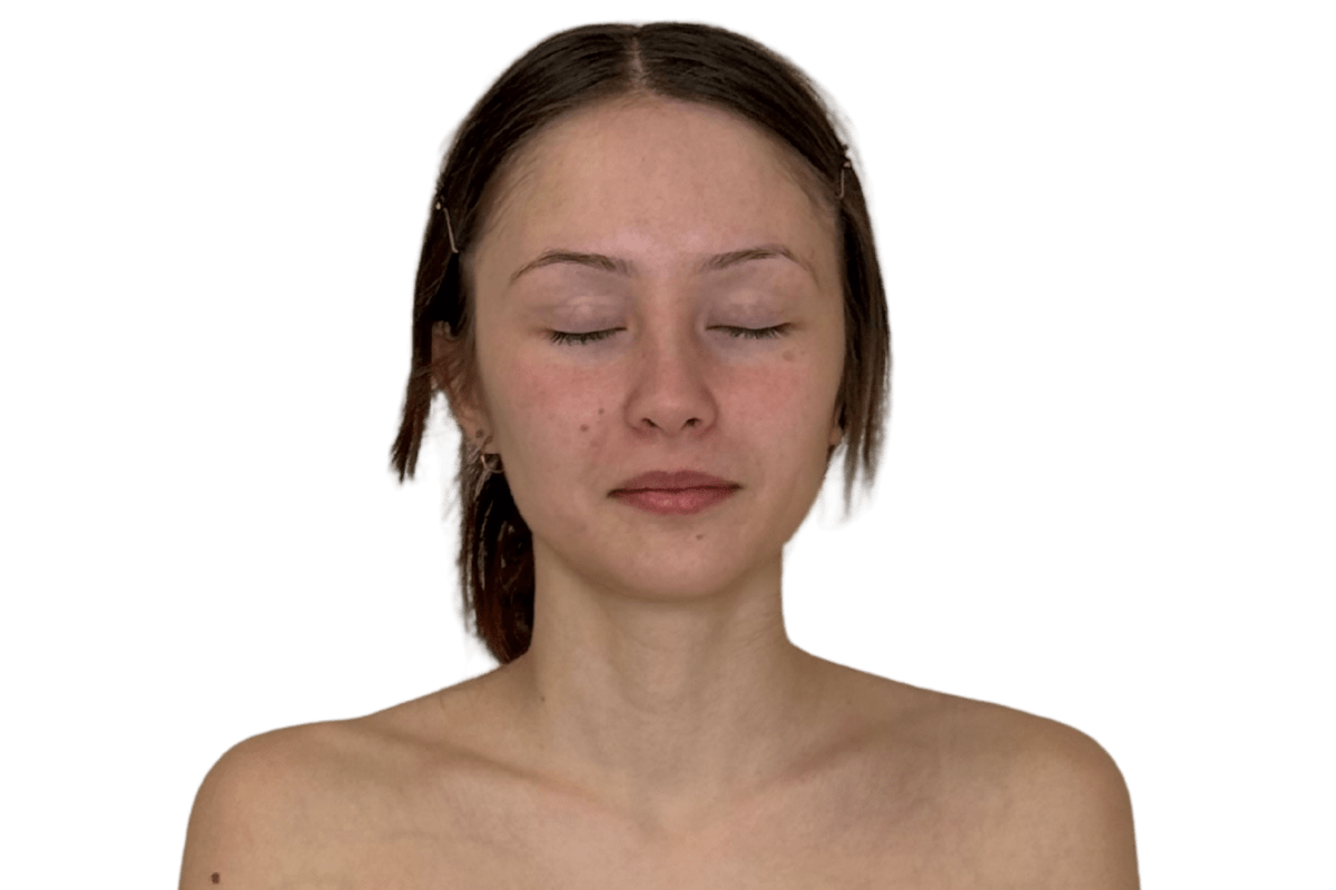 Before the Restorative Buccal Facial at Altru Radiance Murray Utah — held jaw tension, heavier lower face