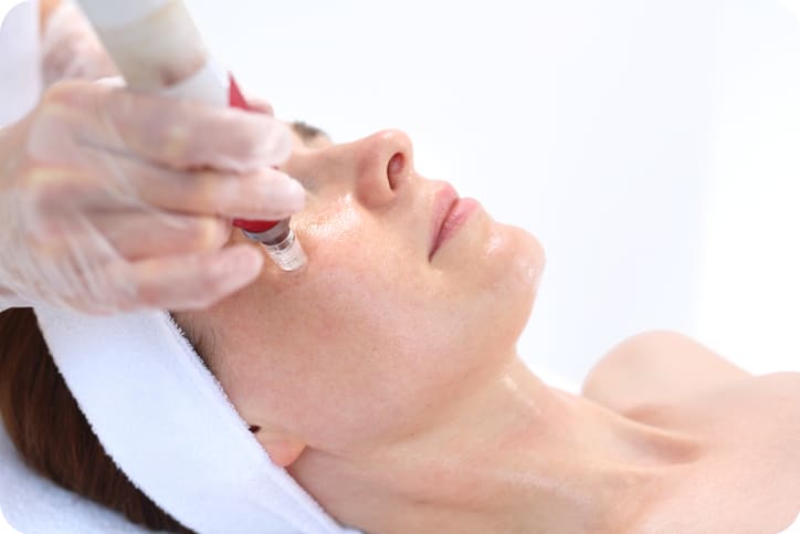 Micro needling: Er det egentlig trygt? Melk & Honning