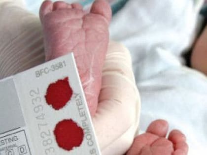 С 1 января 2023 года в России в рамках расширенного неонатального скрининга новорождённых будет проводиться обследование на 36 врождённых и наследственных заболеваний