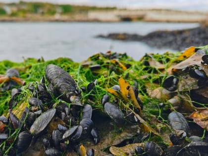 Опасное заболевание обнаружили в Мурманской области