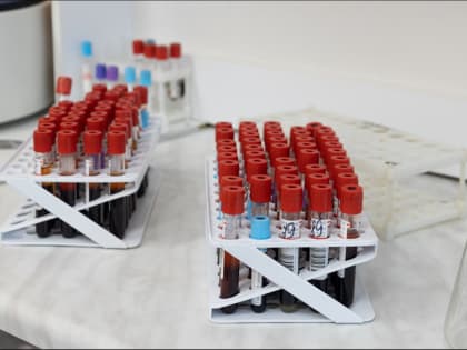 ВИЧ-инфицированный в Мурманской области умышленно заразил восьмиклассницу во время секса