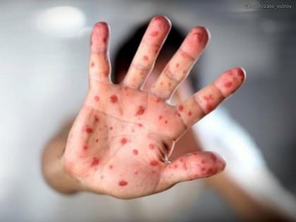 Предприниматели города Мурманска приглашаются на встречу с главой администрации и инвестиционным уполномоченным администрации города Мурманска, приуроченную ко Дню российского пред