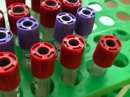 Молодежь Мурманска приглашают пройти экспресс-тестирование на ВИЧ
