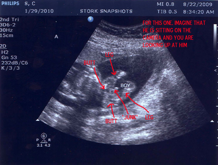 Baby A - proof of manliness