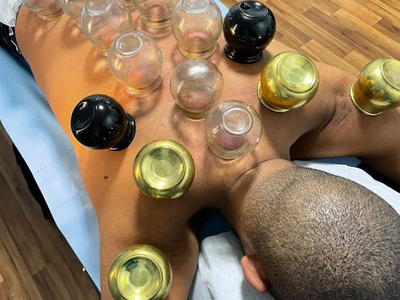 Hijama Tétouan|الحجامة والعلاج الطبيعي تطوان photo 3