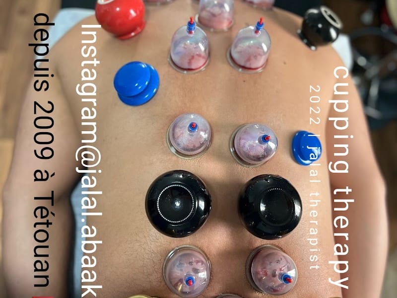 Hijama Tétouan|الحجامة والعلاج الطبيعي تطوان photo 6