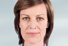 Franca before treatment