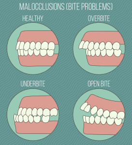 pacifier teeth in adults