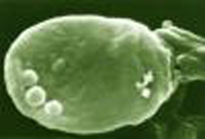 Микоплазменные урогенитальные заболевания. Микоплазма пневмония микробиология. Микоплазма выделения. Гонорейный микоплазмоз. Урогенитальный микоплазмоз.