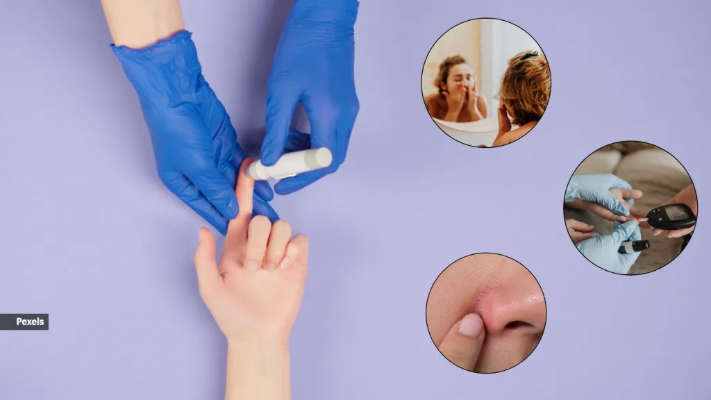 Can You Detect High Blood Sugar by Looking at Someone’s Face? Doctors Explain the Warning Signs