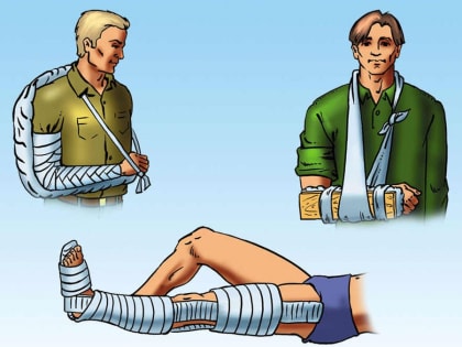 Помощь при переломах, вывихах, ушибах и растяжениях связок