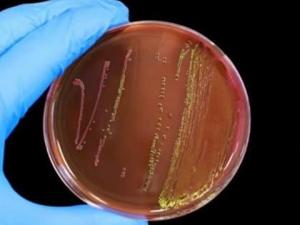 Во Владимирский роддом №2 поставлялось опасное питание