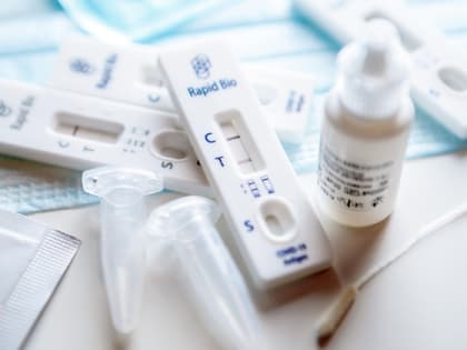 79 случаев заболевания коронавирусом выявлено во Владимирской области 6 марта