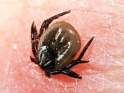 Клещи во Владимирской области напали на 52 человека, в том числе 19 детей