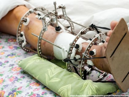 Врачи Областной клинической больницы провели необычную операцию