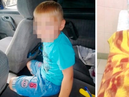 У умершего в ОДКБ мальчика из Юрьев-Польского при эксгумации обнаружили отсутствие почек