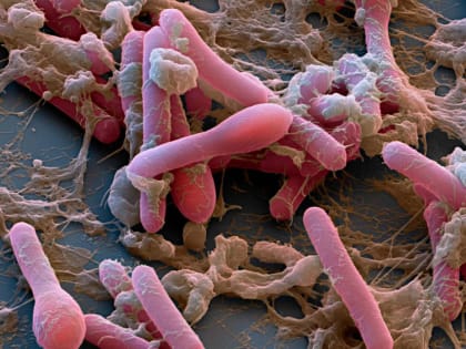 Владимирские врачи готовы к борьбе с ботулизмом