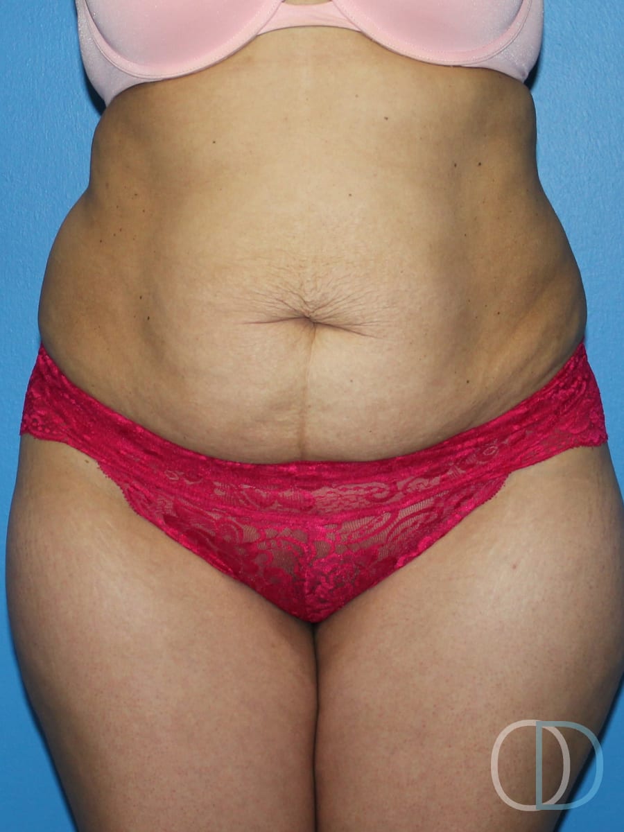 Patient before and after photo