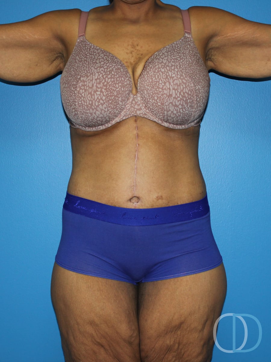 Patient before and after photo