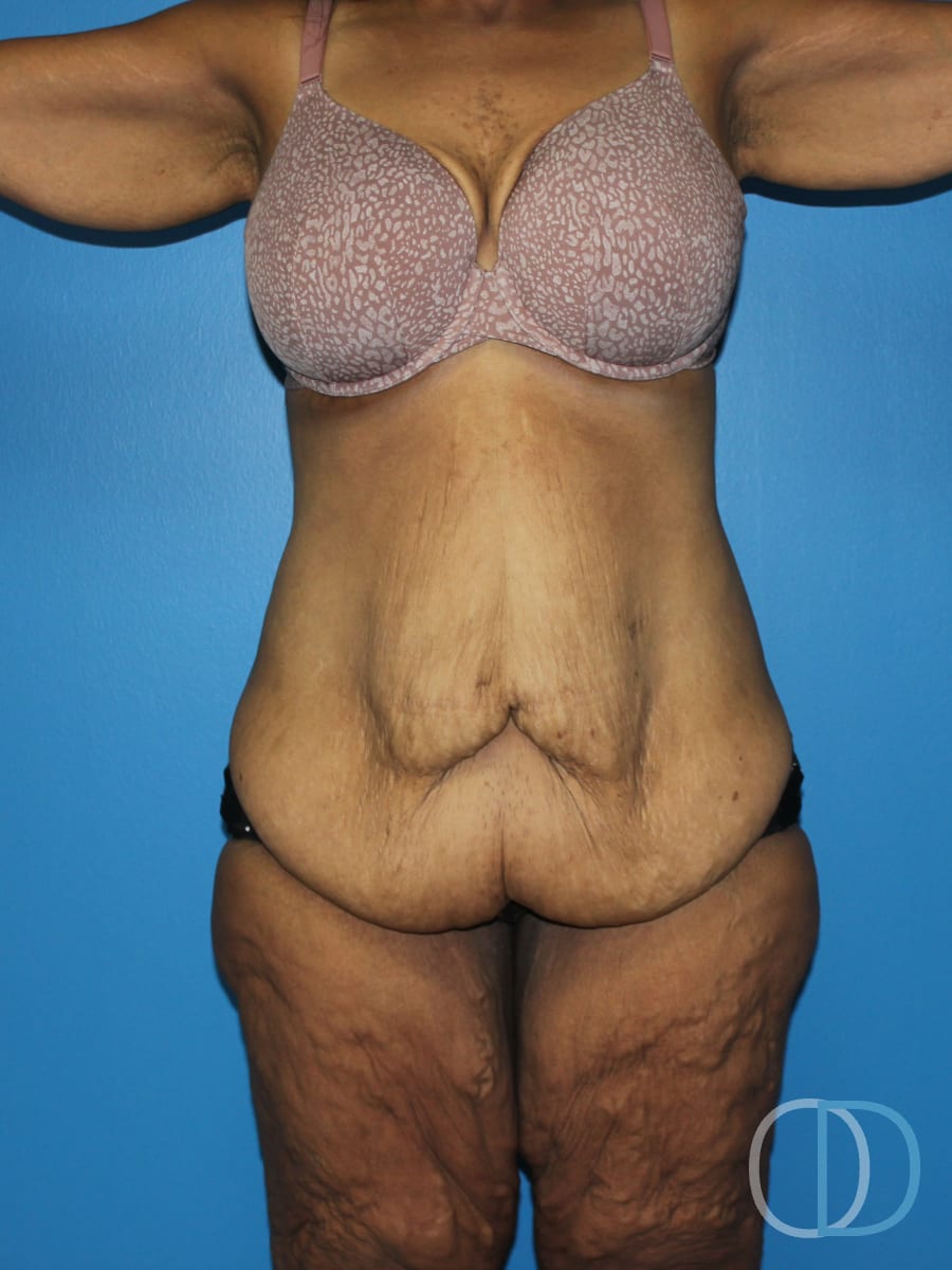 Patient before and after photo
