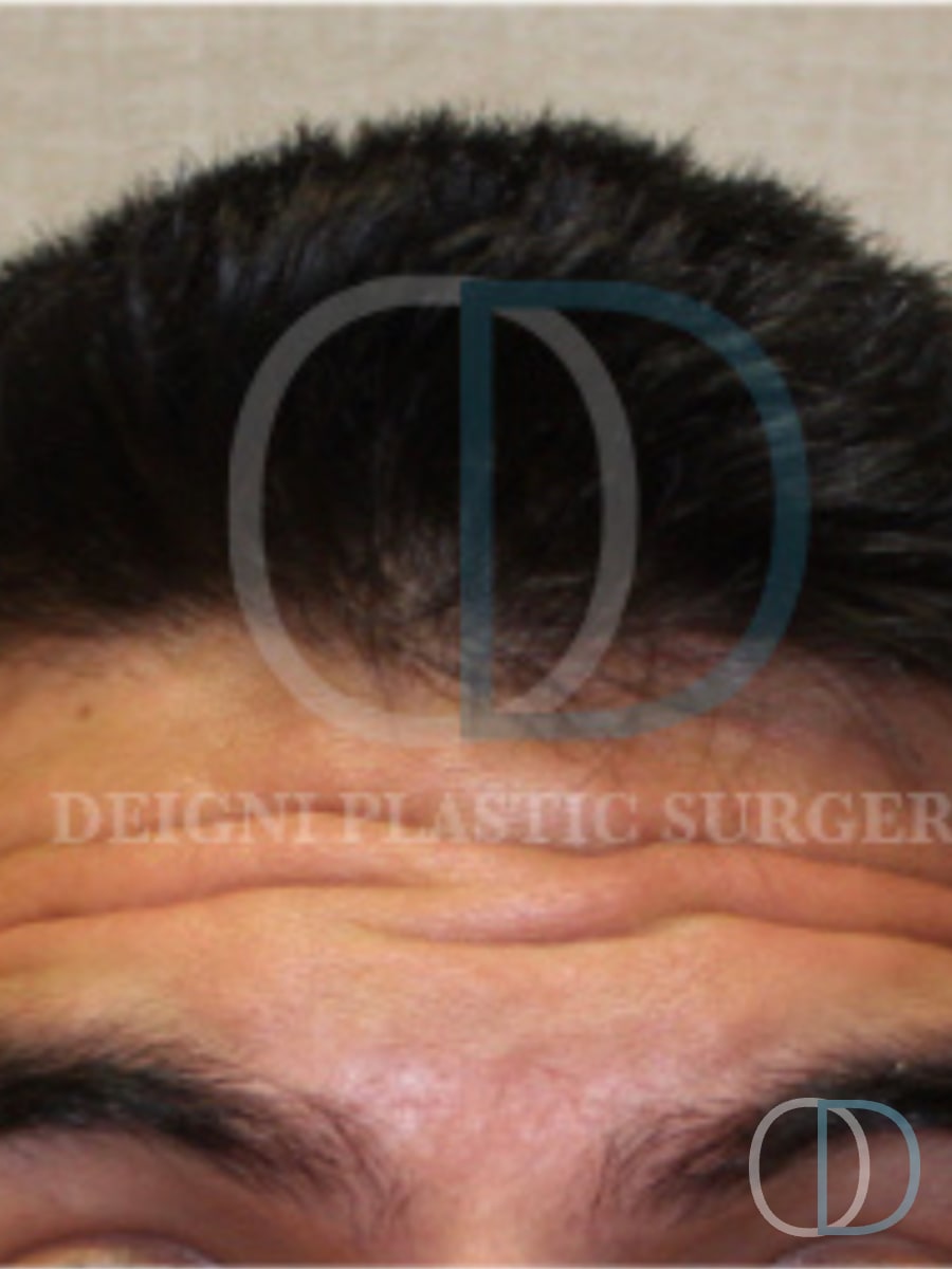 Patient before and after photo