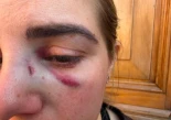 Alt-Agreden a doctora en Villanueva del Rosario: fractura nasal