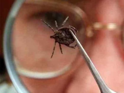 С начала года клещи покусали 50 человек в Забайкалье