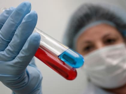 В январе в Забайкалье выявлено 38 новых случаев ВИЧ