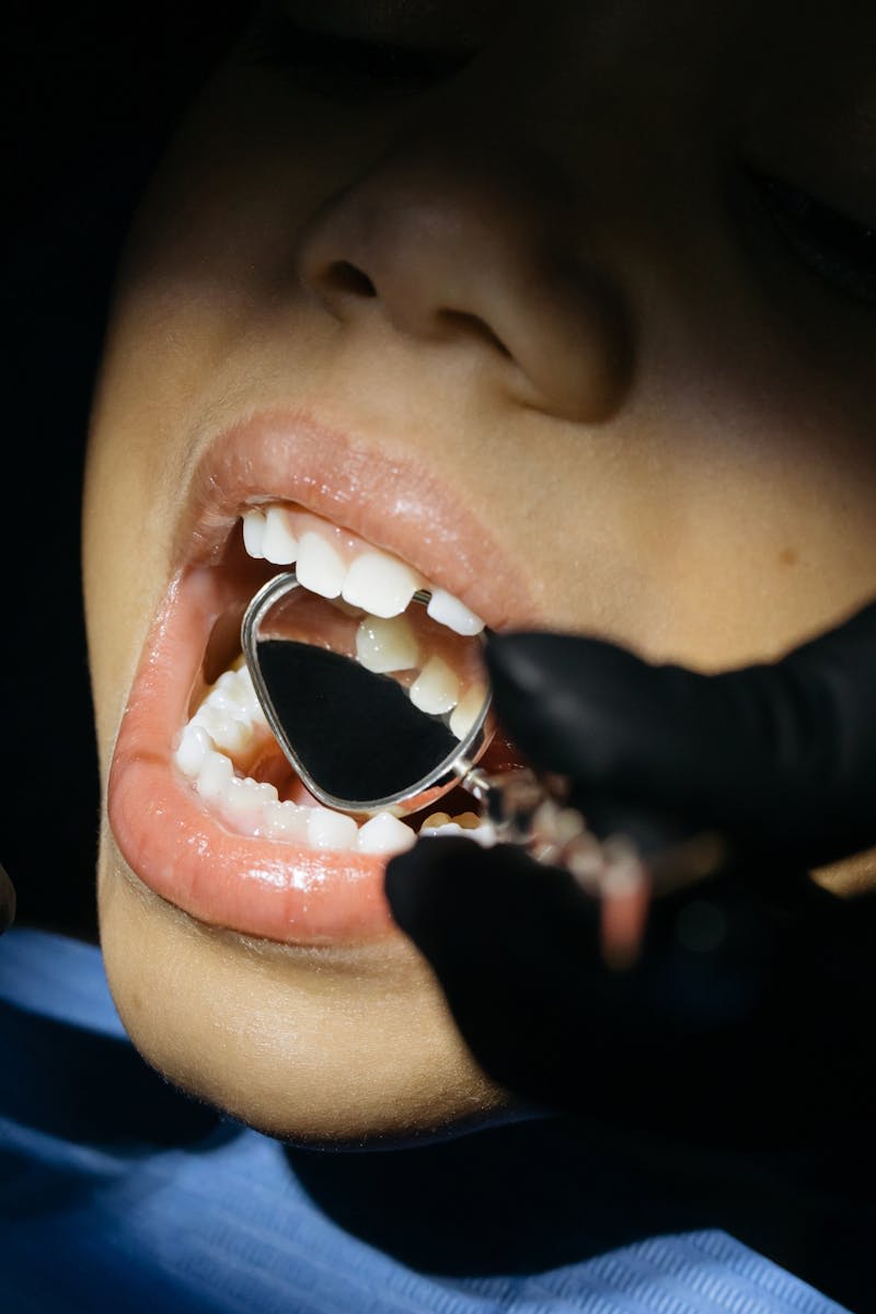 snow teeth whitening