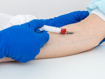 Будет как в юности: 100 мл дважды в день — давление 120/80, холестерин до 5 ммоль/л от простого метода очистки сосудов