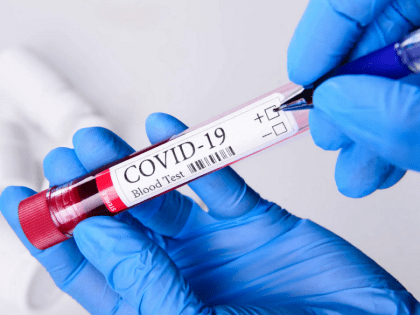 В Мордовии коронавирус за сутки выявляют только у одного жителя региона